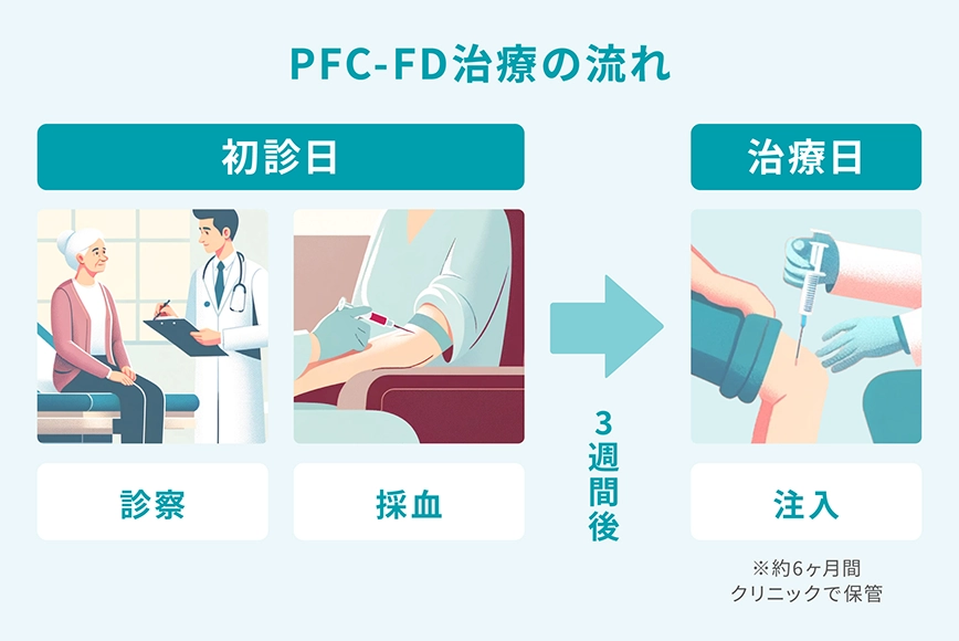 PFC-FD両療の流れ